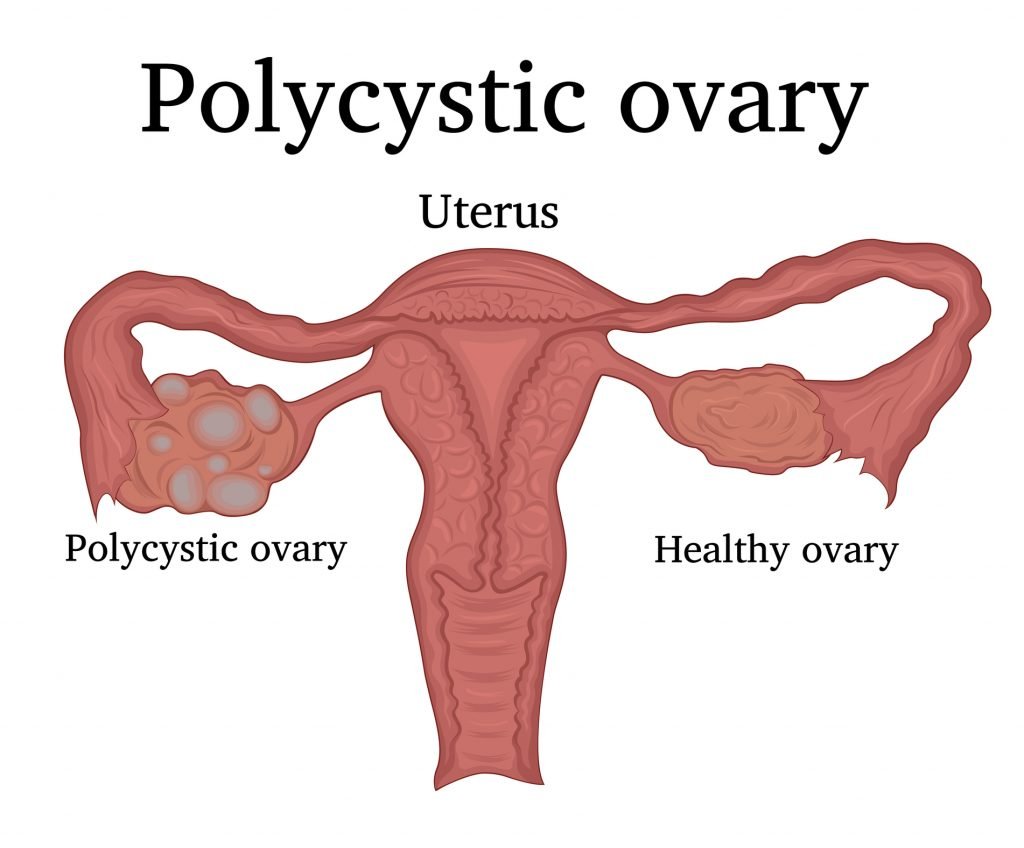 Best Infertility Specialist in Indore