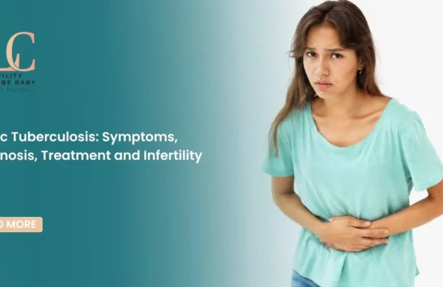 Pelvic Tuberculosis Symptoms, Diagnosis, Treatment and Infertility Risk
