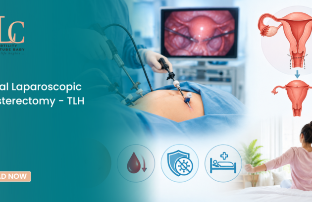 Total Laparoscopic Hysterectomy - TLH